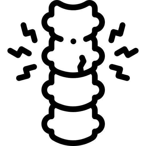 Bel Kayması